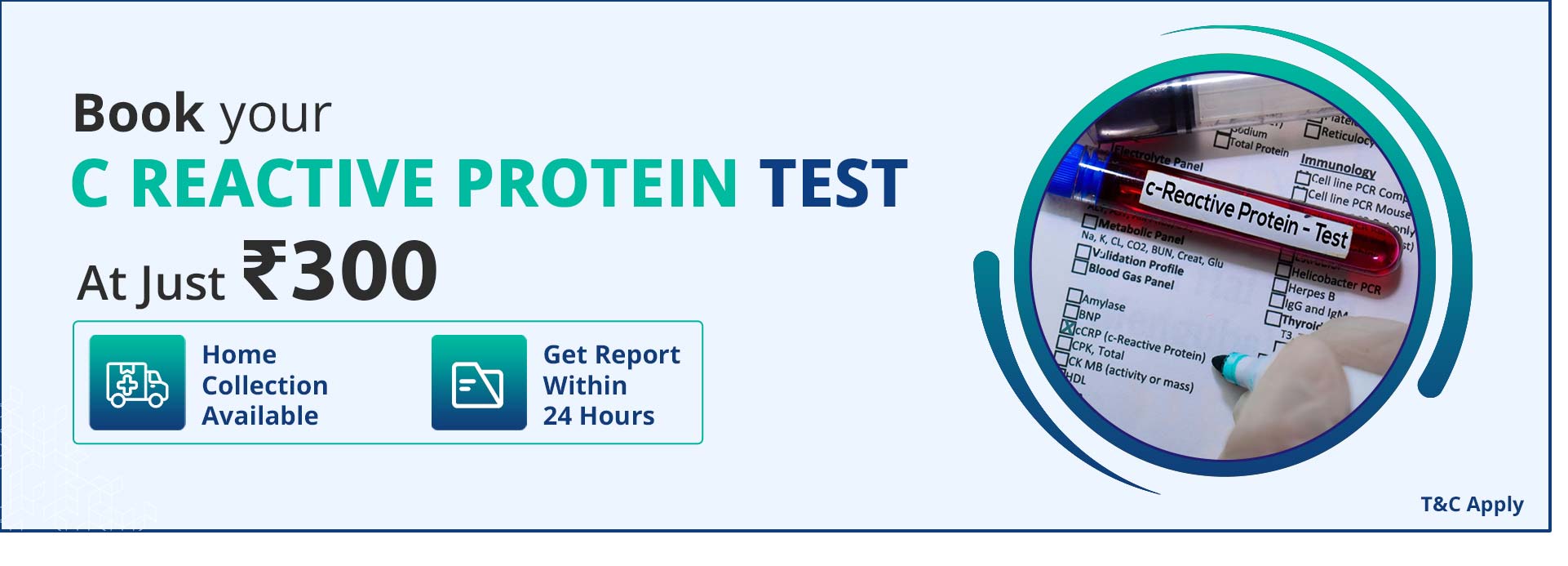 C Reactive Protein Test